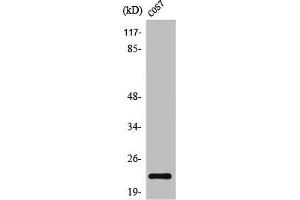 Western Blot analysis of COS7 cells using TNF-β Polyclonal Antibody (LTA antibody  (Internal Region))