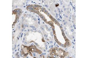 Annexin A3 Antibody for IHC in human kidney tissue (Annexin A3 antibody  (N-Term))