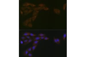 Immunofluorescence analysis of U-2 OS cells using CYPOR Rabbit mAb (ABIN7269151) at dilution of 1:100 (40x lens). (POR antibody)