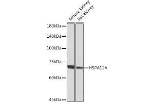 Western blot analysis of extracts of various cell lines, using HSPA Rabbit mAb (ABIN7267576) at 1:1000 dilution. (HSPA12A antibody)