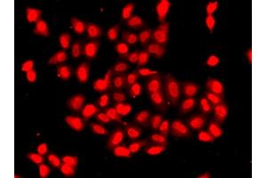 Immunofluorescence analysis of A549 cells using CAMK1D antibody (ABIN5975586). (CAMK1D antibody)
