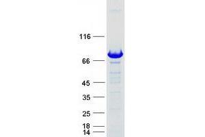 Western Blotting (WB) image for Adaptor Protein, phosphotyrosine Interaction, PH Domain and Leucine Zipper Containing 2 (APPL2) protein (Myc-DYKDDDDK Tag) (ABIN2714848)