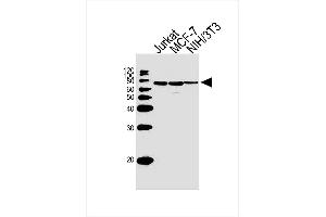 Lane 1: Jurkat Cell lysates, Lane 2: MCF-7 Cell lysates, Lane 3: NIH/3T3 Cell lysates, probed with RPS6KB2 (164CT21. (RPS6KB2 antibody)