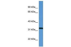 Western Blot showing ZAP70 antibody used at a concentration of 1 ug/ml against Fetal Lung Lysate (ZAP70 antibody  (N-Term))