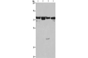 Western Blotting (WB) image for anti-Kruppel-Like Factor 11 (KLF11) antibody (ABIN2421769)