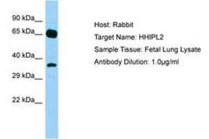 Image no. 1 for anti-HHIP-Like 2 (HHIPL2) (AA 606-655) antibody (ABIN6750191) (HHIPL2 antibody  (AA 606-655))