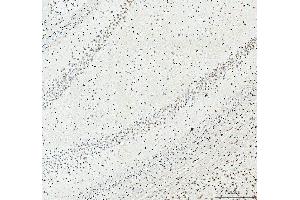IHC analysis of SFPQ using anti-SFPQ antibody (ABIN7603089).