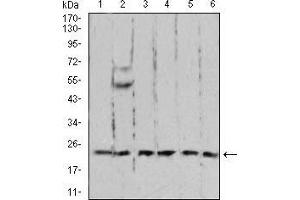 Western blot analysis using RAN mouse mAb against A431 (1), C6 (2), Jurkat (3), Hela (4), COS7 (5), and Jurkat (6) cell lysate. (RAN antibody  (AA 1-216))