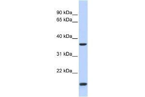 WB Suggested Anti-ZIC4 Antibody Titration:  0. (ZIC4 antibody  (N-Term))