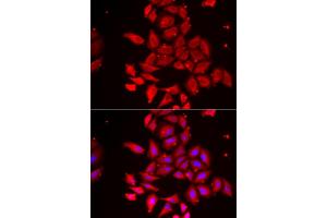 Immunofluorescence analysis of U2OS cells using TMOD4 antibody (ABIN5974100).