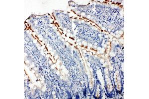 Anti-Zonula occludens protein 3 antibody, IHC(P) IHC(P): Rat Intestine Tissue (TJP3 antibody  (C-Term))