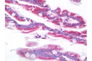 Anti-SCNN1B / ENaC Beta antibody IHC staining of human intestine. (SCNN1B antibody  (AA 306-332))