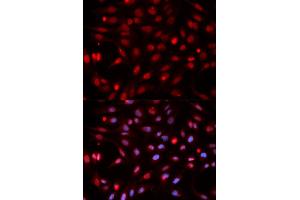 Immunofluorescence analysis of HeLa cells using APEX1 antibody. (APEX1 antibody)
