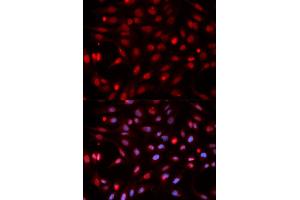 Immunofluorescence analysis of HeLa cells using APEX1 antibody. (APEX1 antibody)