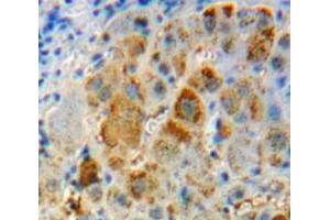 Used in DAB staining on fromalin fixed paraffin- embedded liver tissue (IL-11 antibody  (AA 22-199))