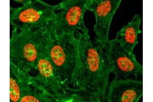 ICC/IF test of HeLa cells treated with sodium butyrate using recombinant H3K18ac antibody (red).