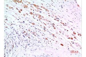 Immunohistochemistry (IHC) analysis of paraffin-embedded Human Brain, antibody was diluted at 1:100. (ZKSCAN4 antibody  (Internal Region))