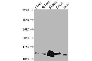 Western Blot Positive WB detected in: Mouse Liver tissue, Mouse Spleen tissue, Mouse kidney tissue, Mouse Brain tissue, Hela whole cell lysate All lanes: Mif antibody at 1:2000 Secondary Goat polyclonal to rabbit IgG at 1/50000 dilution Predicted band size: 13 kDa Observed band size: 13 kDa (MIF antibody  (AA 2-115))