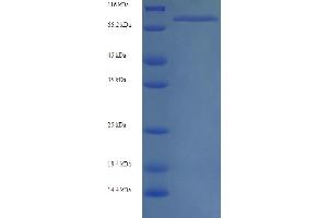 SDS-PAGE (SDS) image for Myosin Heavy Chain 6, Cardiac Muscle, alpha (MYH6) (AA 160-816), (partial) protein (His tag) (ABIN5713688) (MYH6 Protein (AA 160-816, partial) (His tag))