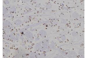 ABIN6277441 at 1/100 staining Rat brain tissue by IHC-P. (SUMO4 antibody)