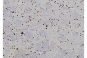 ABIN6277441 at 1/100 staining Rat brain tissue by IHC-P. (SUMO4 antibody)