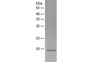 Western Blotting (WB) image for Small Breast Epithelial Mucin (SBEM) (AA 21-90) protein (His tag) (ABIN7125125) (SBEM Protein (AA 21-90) (His tag))