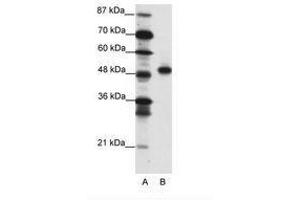 Image no. 1 for anti-Mesenchyme Homeobox 2 (MEOX2) (C-Term) antibody (ABIN202201)