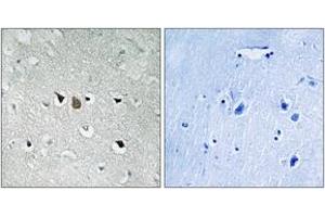 Immunohistochemistry analysis of paraffin-embedded human brain tissue, using C-RAF (Ab-269) Antibody.