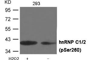 Western blot analysis of extracts from 293 cells untreated or treated with H2O2 using hnRNP C1/2 (Phospho-Ser260) Antibody . (HNRNPC antibody  (pSer260))