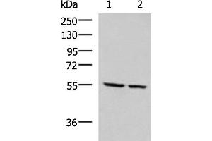 Western blot analysis of LOVO and LO2 cell lysates using ECM1 Polyclonal Antibody at dilution of 1:650 (ECM1 antibody)