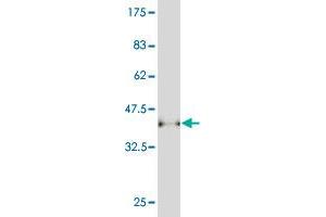 Western Blot detection against Immunogen (37. (ADCY5 antibody  (AA 1152-1261))