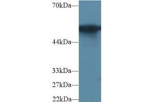 Western blot analysis of Rat Colon lysate, using Rat G6PD Antibody (2 µg/ml) and HRP-conjugated Goat Anti-Rabbit antibody (