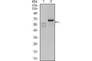 Western blot analysis using CA9 mouse mAb against A431 (1) and SW620 (2) cell lysate. (CA9 antibody  (AA 37-186))