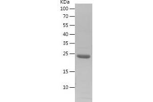 Western Blotting (WB) image for Jun Proto-Oncogene (JUN) (AA 75-274) protein (His tag) (ABIN7283138) (C-JUN Protein (AA 75-274) (His tag))