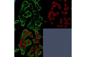 Confocal immunofluorescence analysis of MCF-7 cells using EpCAM Mouse Recombinant Monoclonal Antibody (rMOC-31) labeled in Green. (Recombinant EpCAM antibody)