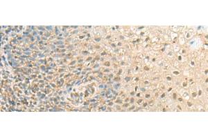 Immunohistochemistry of paraffin-embedded Human tonsil tissue using PPCDC Polyclonal Antibody at dilution of 1:55(x200) (PPCDC antibody)