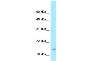 WB Suggested Anti-BAD Antibody Titration: 1. (BAD antibody  (Middle Region))