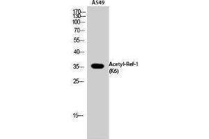 Western Blotting (WB) image for anti-Apurinic/Apyrimidinic Endonuclease 1 (APEX1) (acLys6) antibody (ABIN3172828) (APEX1 antibody  (acLys6))
