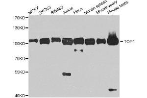 Western blot analysis of extracts of various cell lines, using TOP1 antibody.
