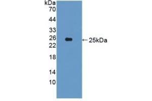 Detection of Recombinant CDCP1, Human using Polyclonal Antibody to CUB Domain Containing Protein 1 (CDCP1) (CDCP1 antibody  (AA 689-836))