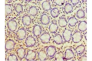 Immunohistochemistry of paraffin-embedded human colon tissue using ABIN7168119 at dilution of 1:100 (POP7 antibody  (AA 1-140))