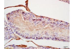 Formalin-fixed and paraffin embedded rat testis labeled with Rabbit Anti FGF8/HBGF-8 Polyclonal Antibody, Unconjugated (ABIN672516) at 1:200 followed by conjugation to the secondary antibody and DAB staining (FGF8 antibody  (AA 131-233))