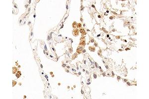 Immunohistochemistry analysis of paraffin-embedded human lung using CXCR7 Polyclonal Antibody at dilution of 1:100. (CXCR7 antibody)