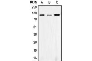 Western blot analysis of CD172a expression in THP1 (A), AML193 (B), HL60 (C) whole cell lysates.