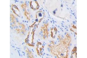 IHC-P analysis of kidney tissue, with DAB staining. (SPTLC3 antibody  (AA 238-552))