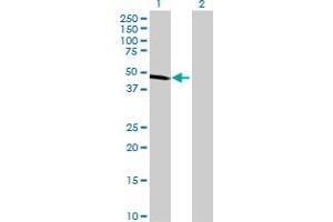 Western Blot analysis of ALDH9A1 expression in transfected 293T cell line by ALDH9A1 MaxPab polyclonal antibody. (ALDH9A1 antibody  (AA 1-494))