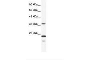 Image no. 1 for anti-Zinc Finger Protein 688 (ZNF688) (AA 95-144) antibody (ABIN203041)