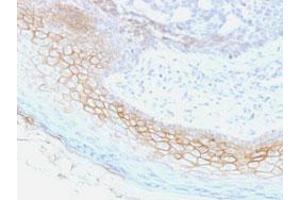 Immunohistochemical staining (Formalin-fixed paraffin-embedded sections) of human skin with DSC2/DSC3 monoclonal antibody, clone 7G6 . (Desmocollin 2 antibody  (Extracellular Domain))