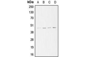 Western blot analysis of ARP3 expression in A549 (A), Jurkat (B), HeLa (C), A431 (D) whole cell lysates.