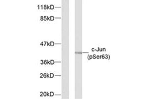 Western blot analysis of extracts from NIH/3T3 cells using JUN (phospho S63) polyclonal antibody . (C-JUN antibody  (pSer63))